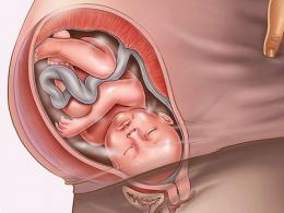 प्रारंभिक गर्भावस्था में पीठ के निचले हिस्से में दर्द क्यों होता है?